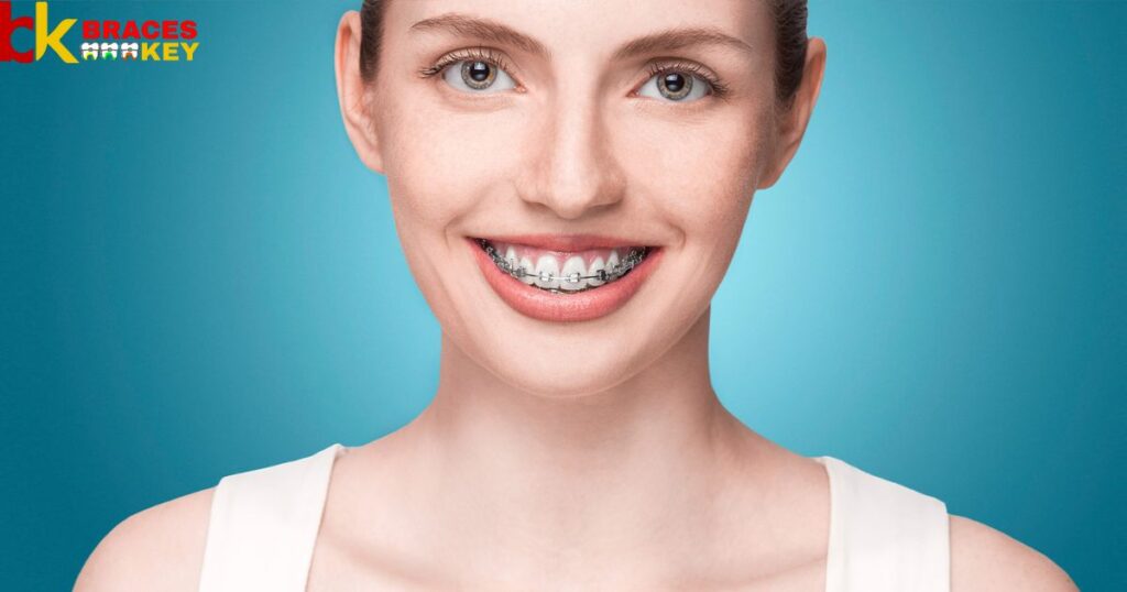 What Is The Cost Of Teeth Braces In India