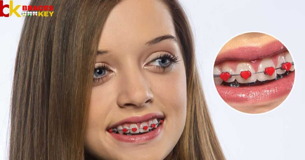 Why Do People Choose Red Braces