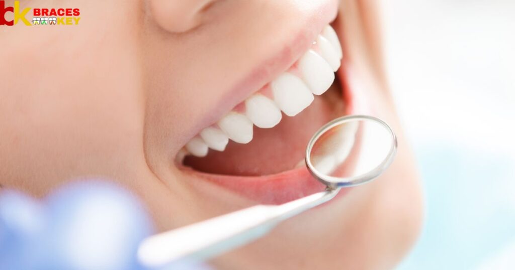 Why Your Teeth Move After Treatment