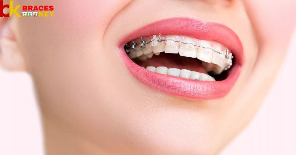 Benefits Of Red Braces