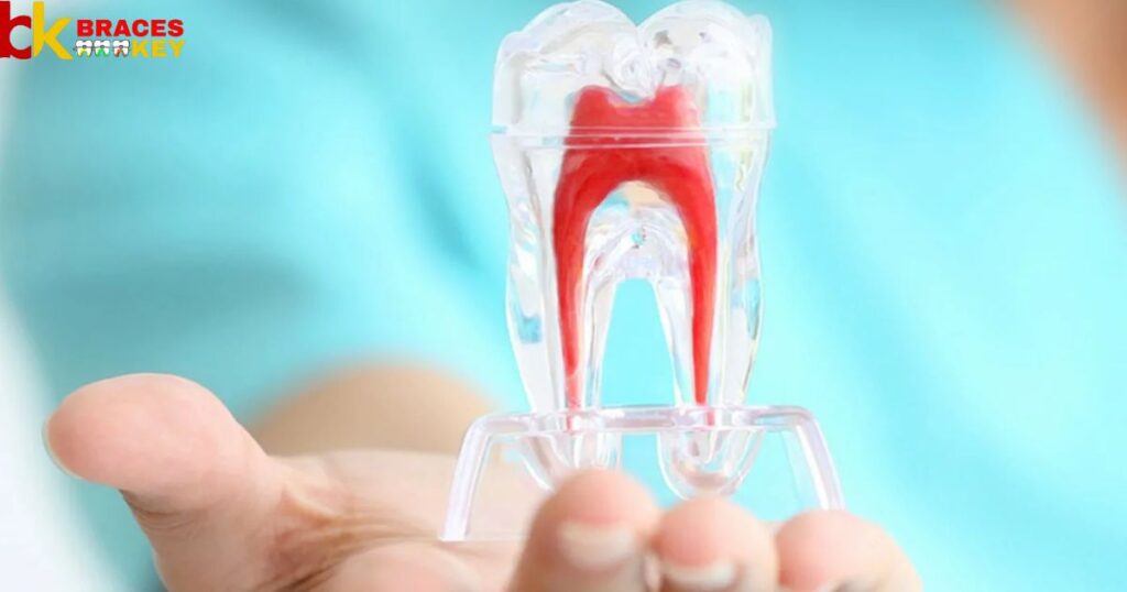 How Does Endodontic Treatment Save The Tooth