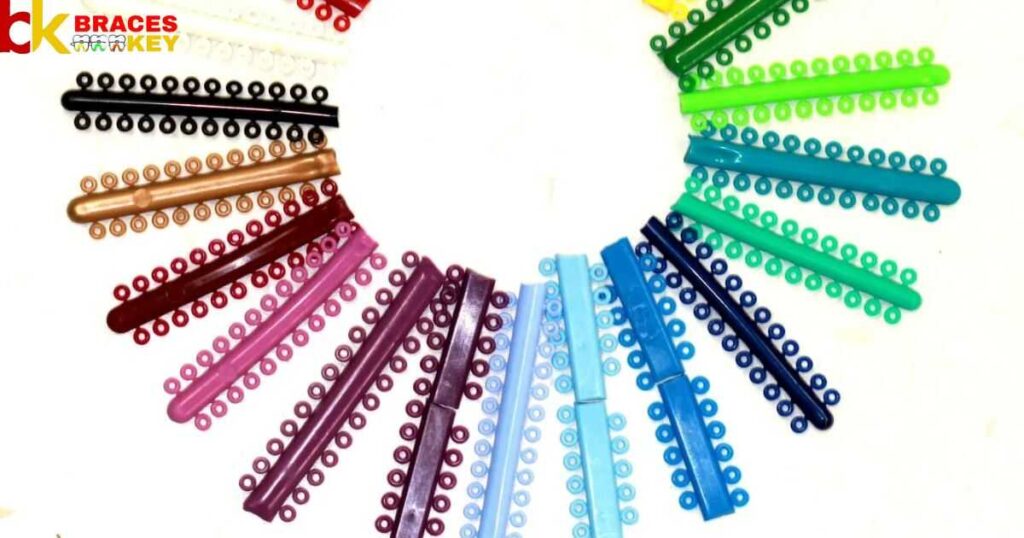 How To Pick The Right Colors For Your Braces