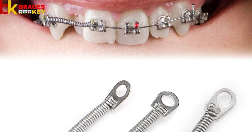 Overview Of Braces Coil Springs