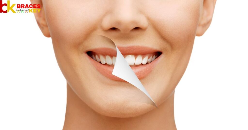 What Are Some Different Teeth-Whitening Methods