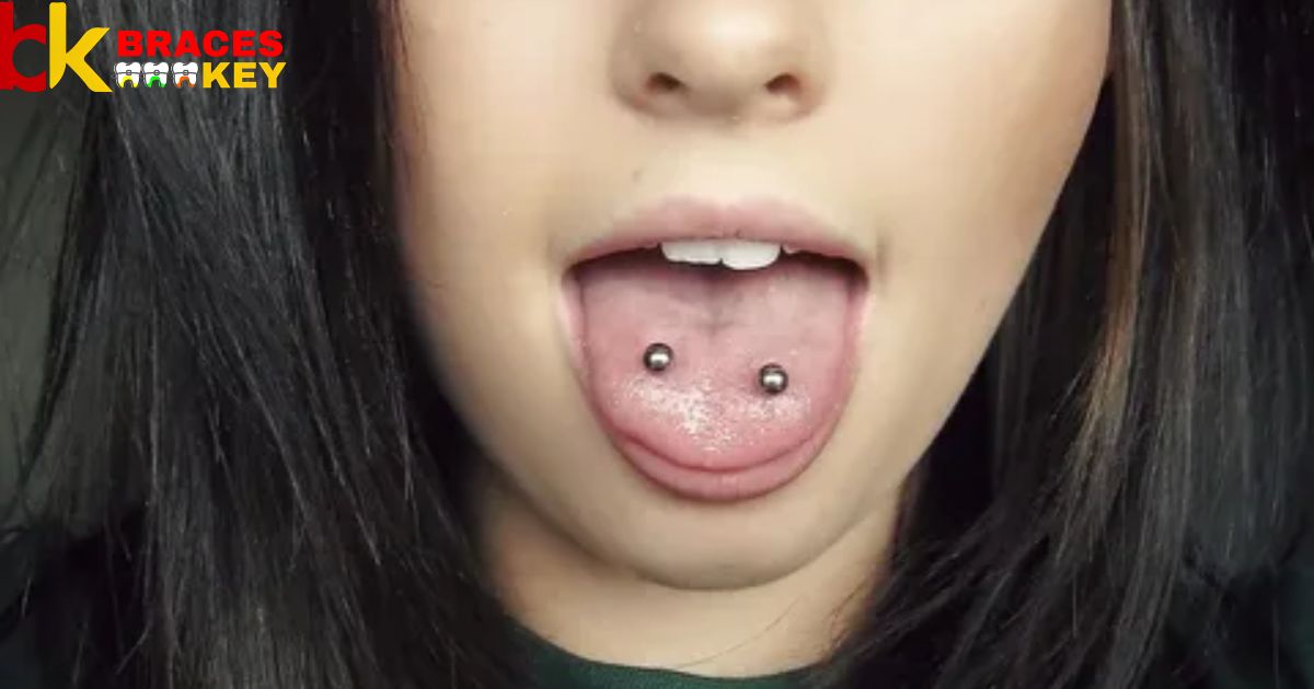 Can You Have A Tongue Piercing With Braces