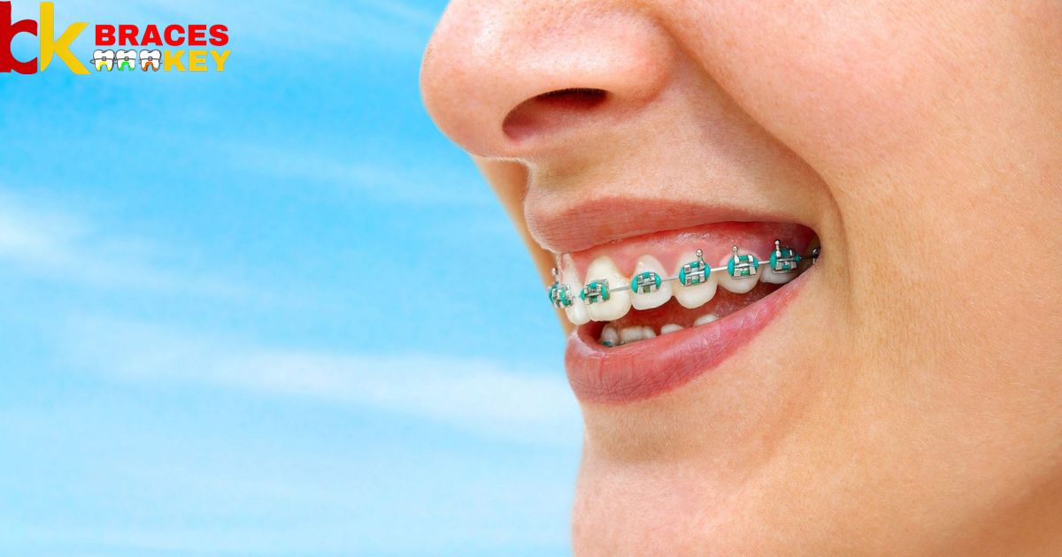 Does Blue Cross Blue Shield Cover Braces For Adults