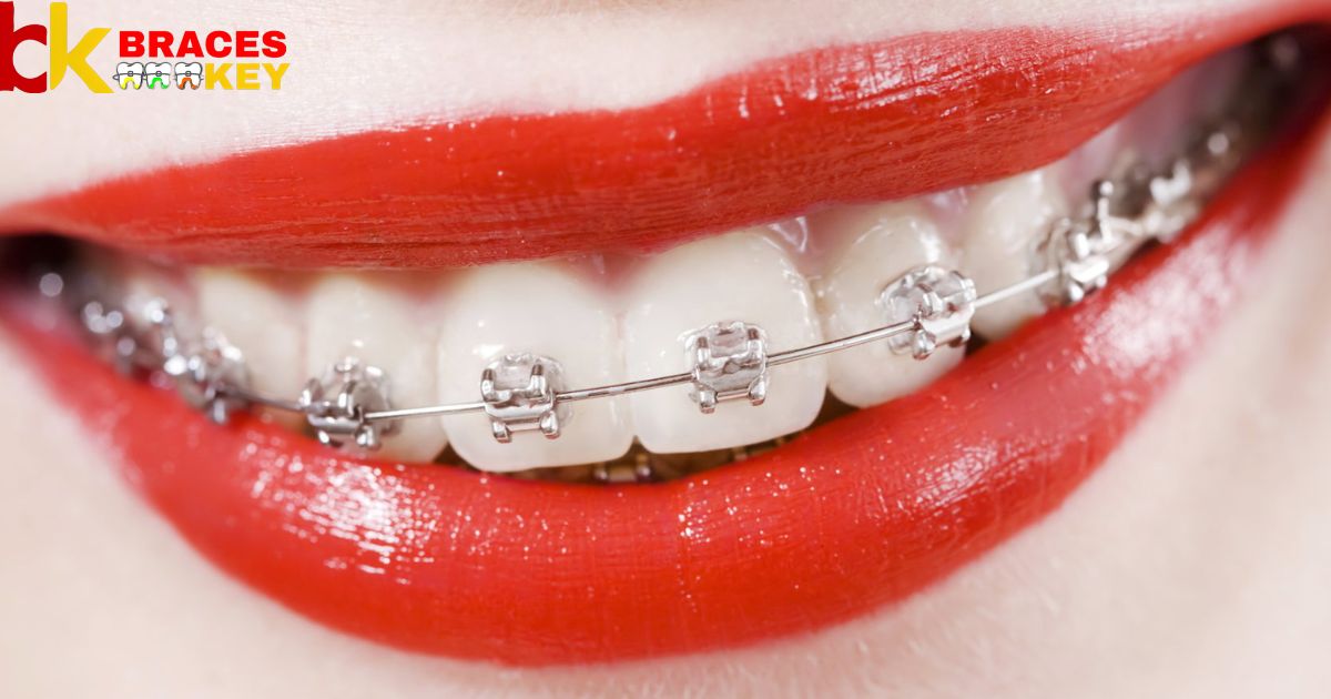 Much Do Braces Cost With Kaiser Insurance