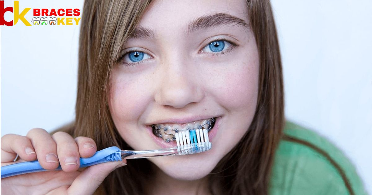 Often Should You Brush Your Teeth With Braces