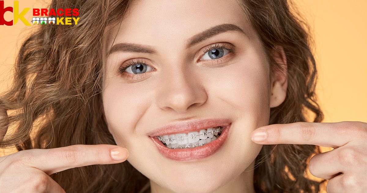What Is The Best Braces Color For Brown Eyes