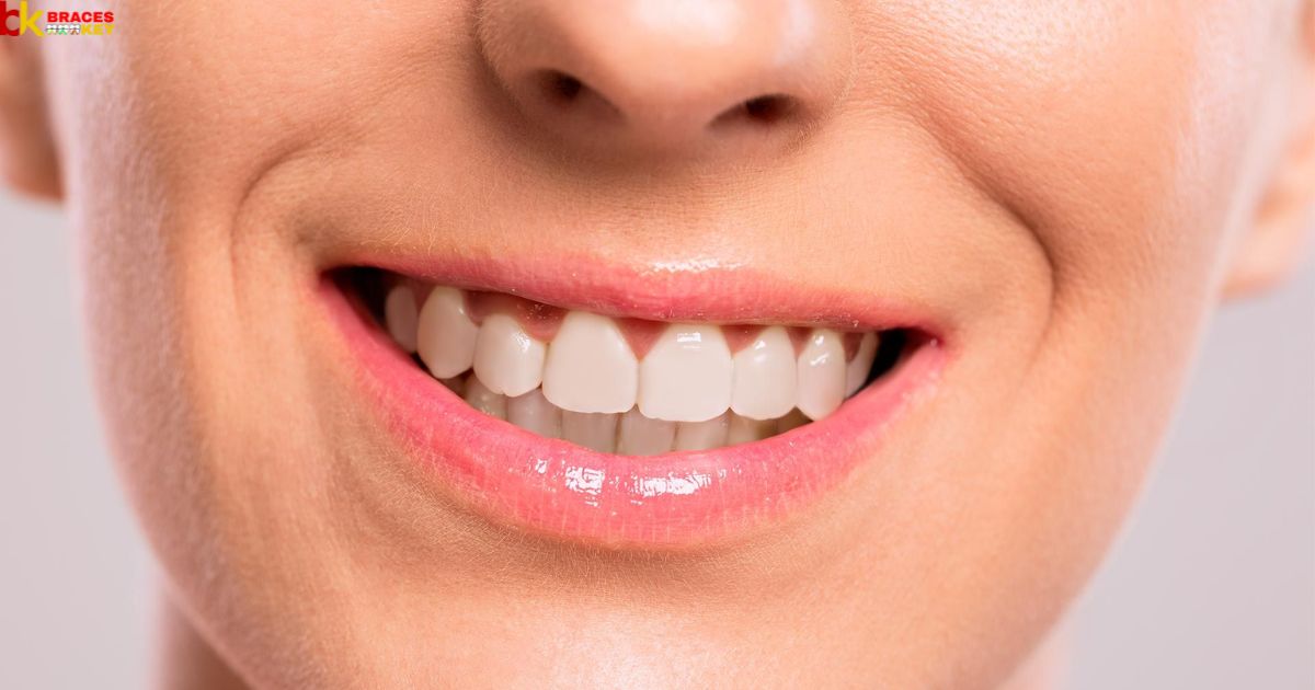 How Can I Tighten My Braces at Home?