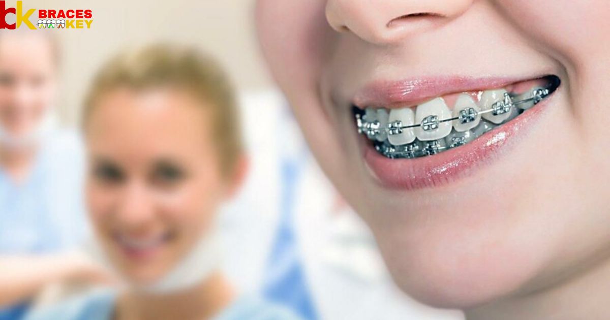 Many Appointments Before Getting Braces