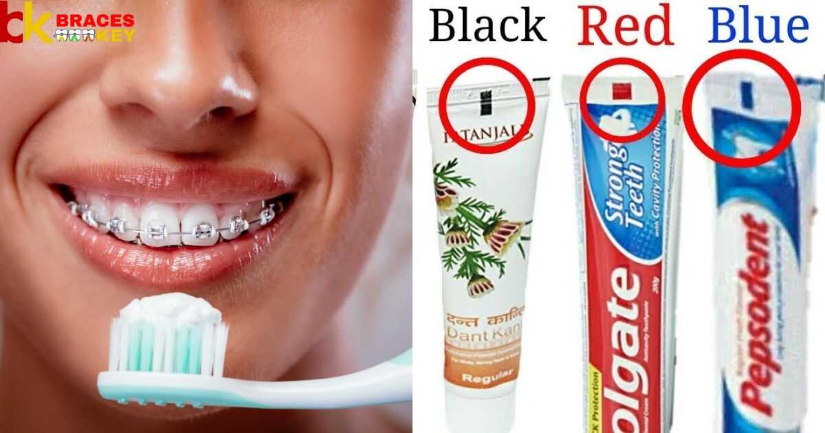 What Is A Toothpaste Color Code For My Braces