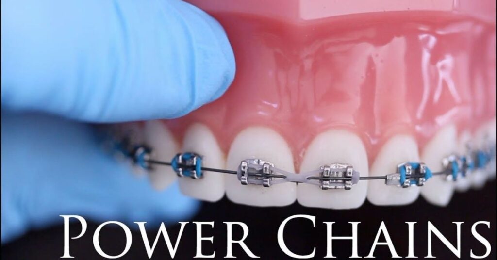 How to Take Care of Your Power Chains?