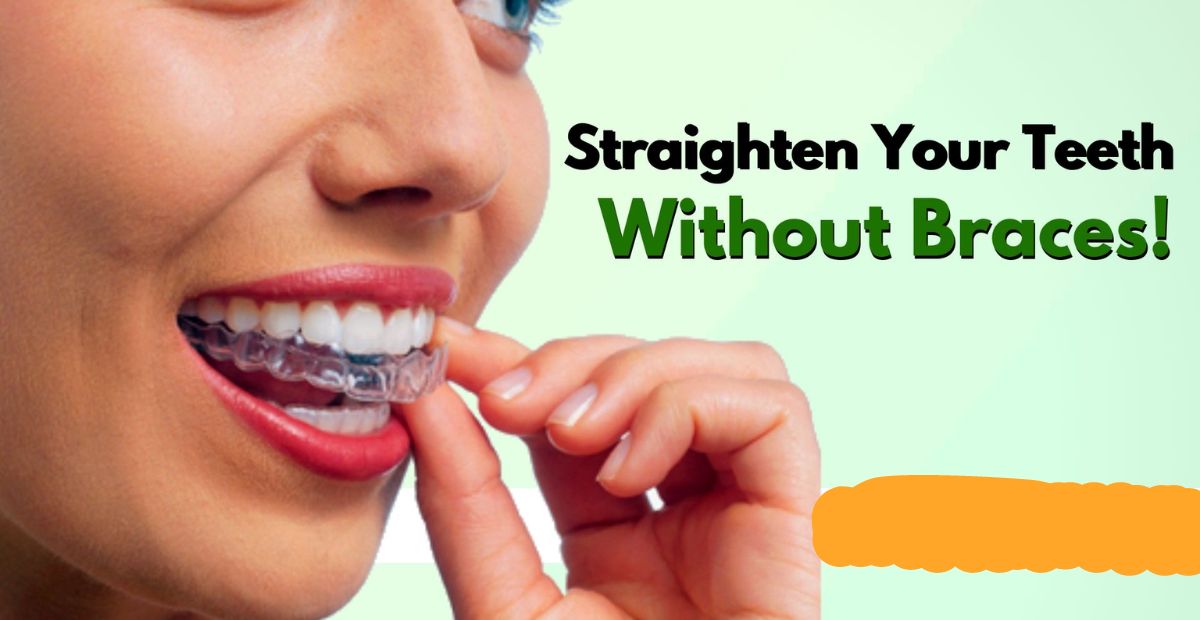 How To Straighten Teeth Without Braces